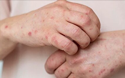 نشانه های کمتر شناخته شده یک روده ناسالم