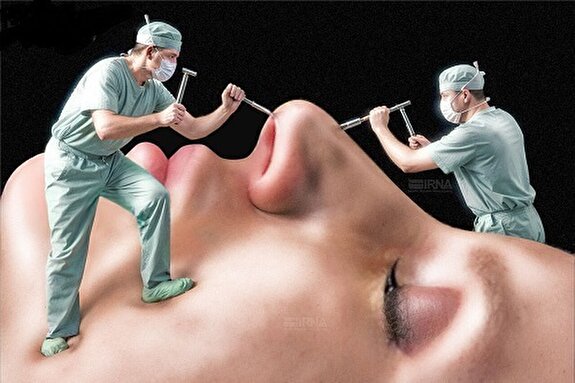 جراحی‌های زیبایی در تقاطع سلامت و فشار اجتماعی